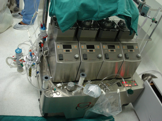 Máquina de CEC em preparação. Máquina de CEC em preparação.